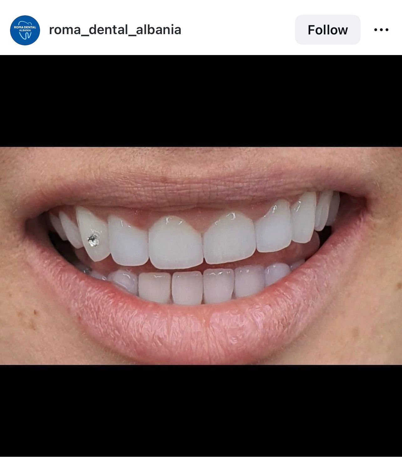 Sorriso perfetto - Risultato finale