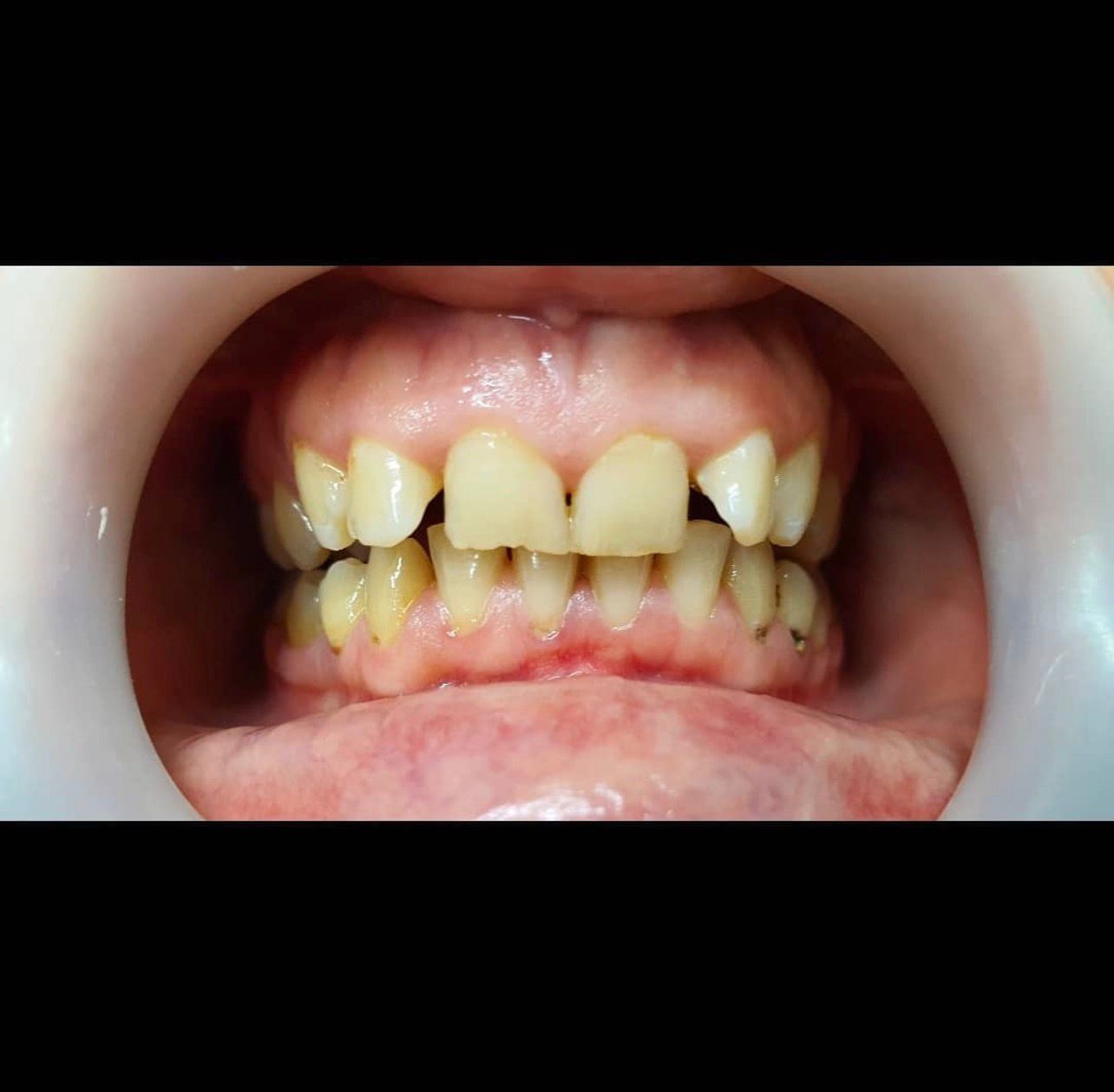 Prima del trattamento - Caso clinico